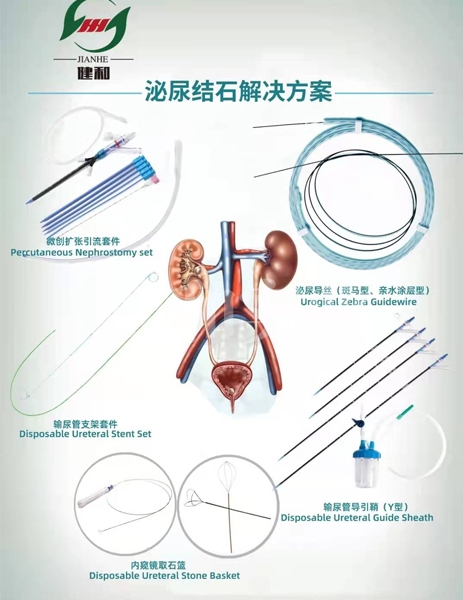 泌尿结石解决方案